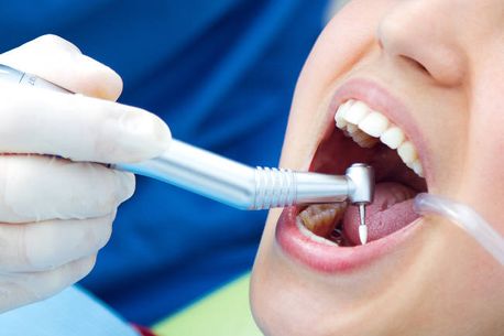 Bilbident tratamiento de endodoncia